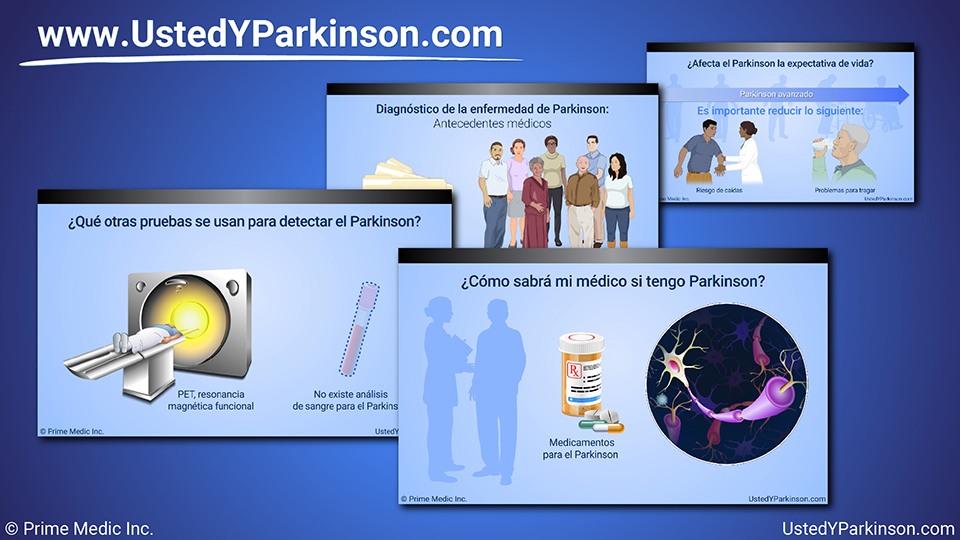 Presentación de diapositivas - Diagnóstico de la enfermedad de Parkinson