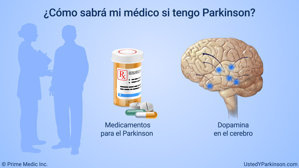 ¿Cómo sabrá mi médico si tengo Parkinson?