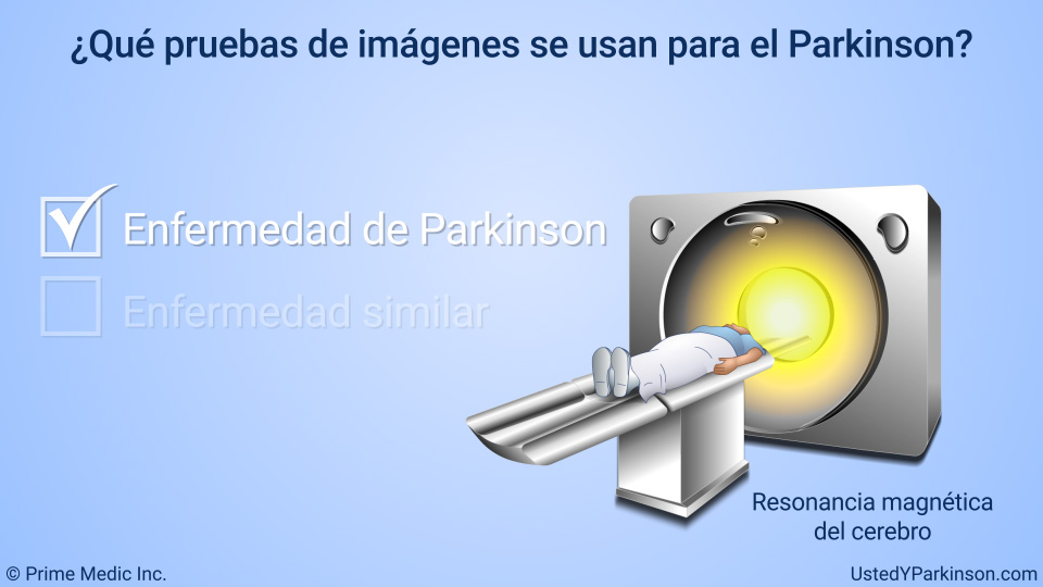¿Qué pruebas de imágenes se usan para el Parkinson?