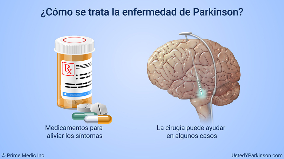 ¿Cómo se trata la enfermedad de Parkinson?
