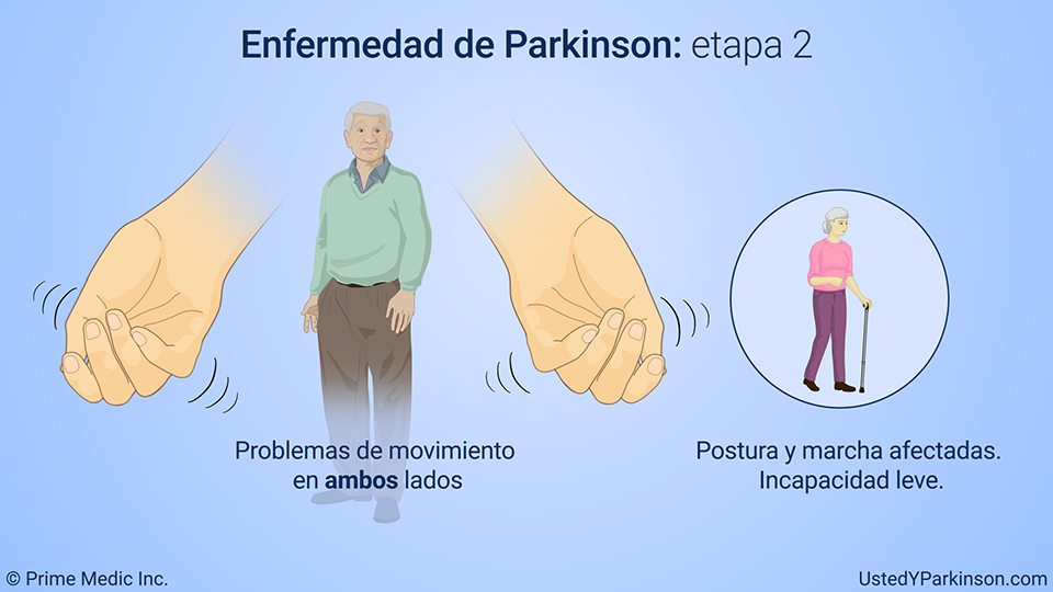 Enfermedad de Parkinson: etapa 2