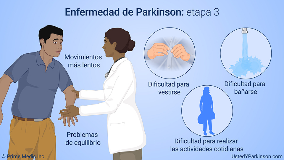 Enfermedad de Parkinson: etapa 3