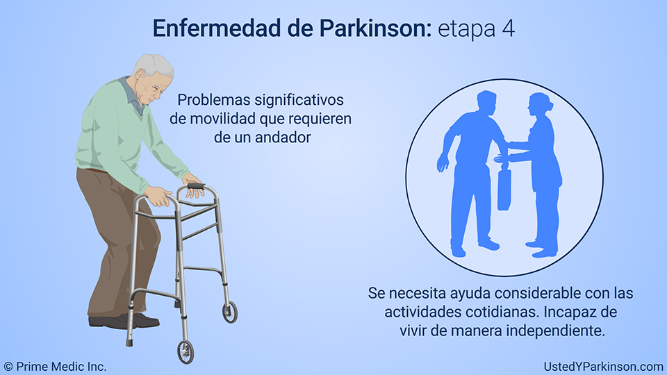 Enfermedad de Parkinson: etapa 4