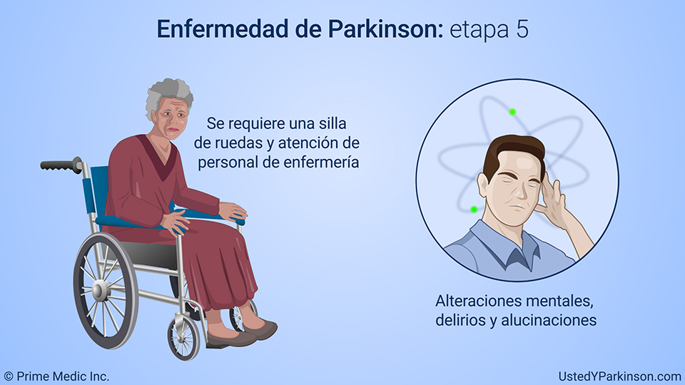 Enfermedad de Parkinson: etapa 5