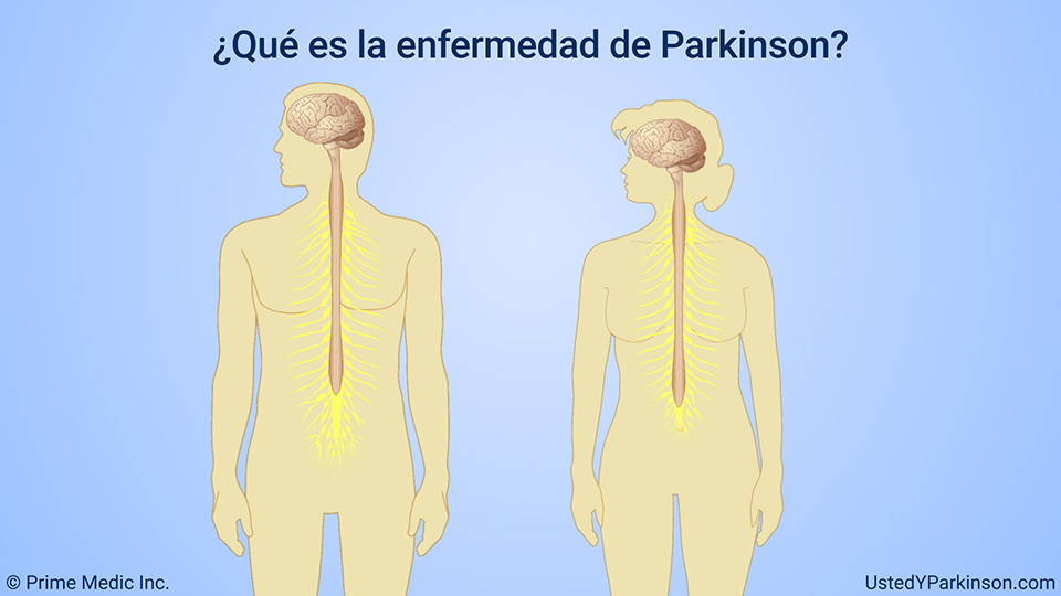 ¿Qué es la enfermedad de Parkinson?