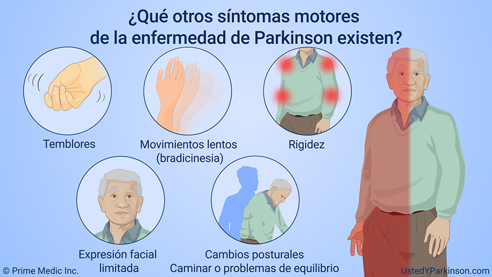 ¿Qué otros síntomas motores de la enfermedad de Parkinson existen?