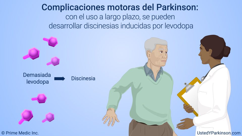 Complicaciones motoras del Parkinson: con el uso a largo plazo, se pueden desarrollar discinesias inducidas por levodopa