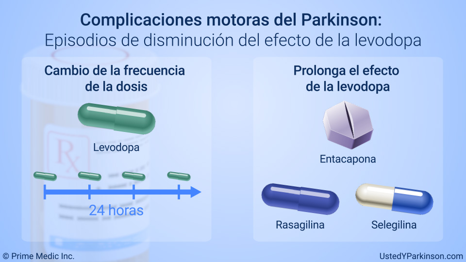 Complicaciones motoras del Parkinson: Episodios de disminución del efecto de la levodopa