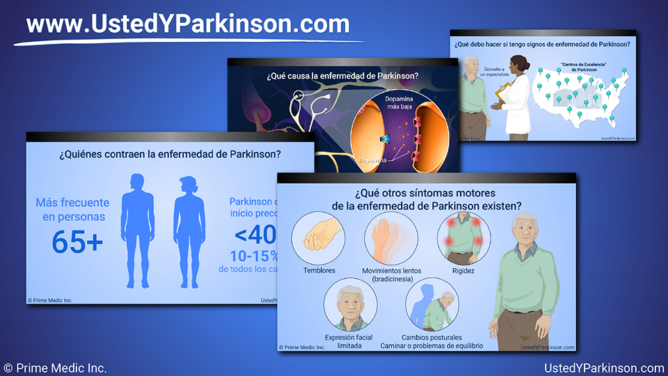 Presentación de diapositivas - Entendiendo la enfermedad de Parkinson